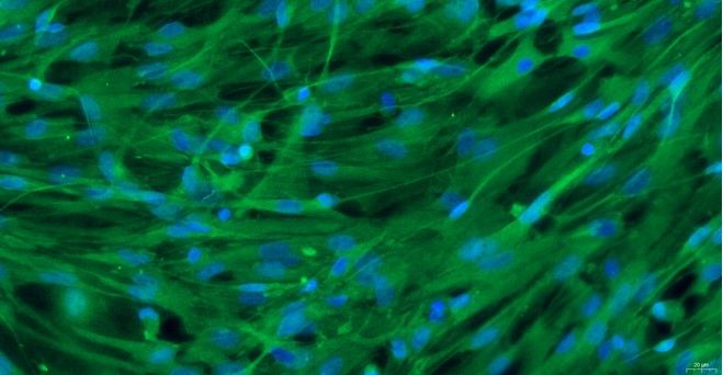 Primary Canine Trigeminal Ganglion Astrocytes (TGA)