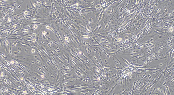 Primary Canine Trigeminal Ganglion Astrocytes (TGA)
