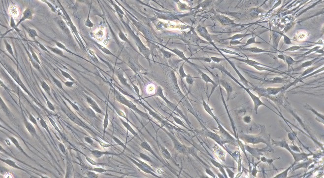 Primary Canine Trigeminal Ganglion Astrocytes (TGA)