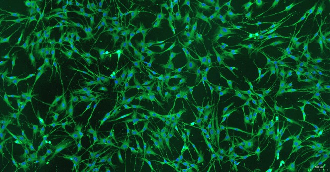 Primary Rat Satellite Glial Cells (SGC)