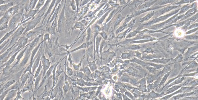 Primary Rat Optic Nerve Astrocytes (ONA)