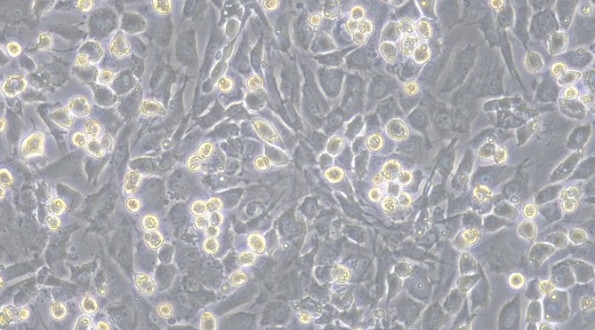 Primary Mouse Costochondral Chondrocytes (CC)