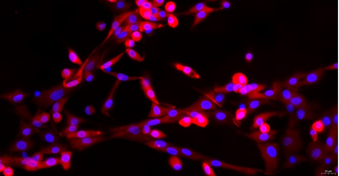 Primary Mouse Costochondral Chondrocytes (CC)