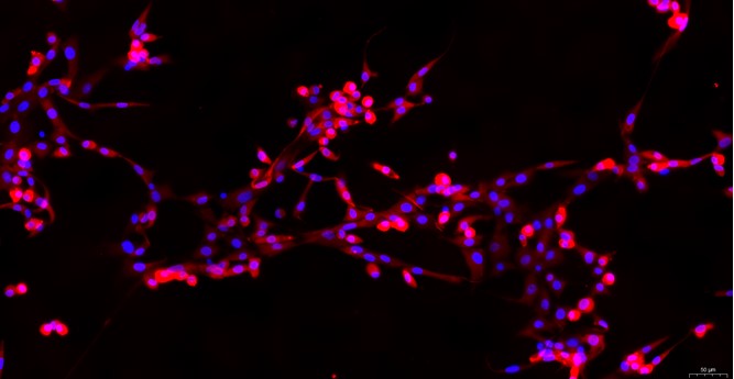 Primary Mouse Costochondral Chondrocytes (CC)