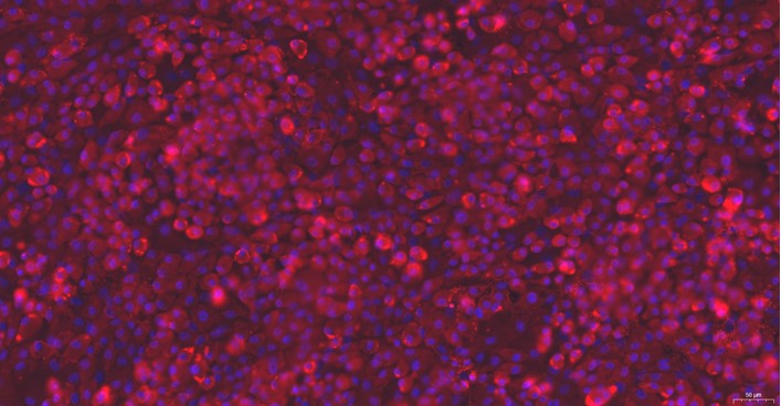 Primary Rat Costochondral Chondrocytes (CC)
