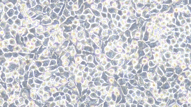 Primary Rat Costochondral Chondrocytes (CC)