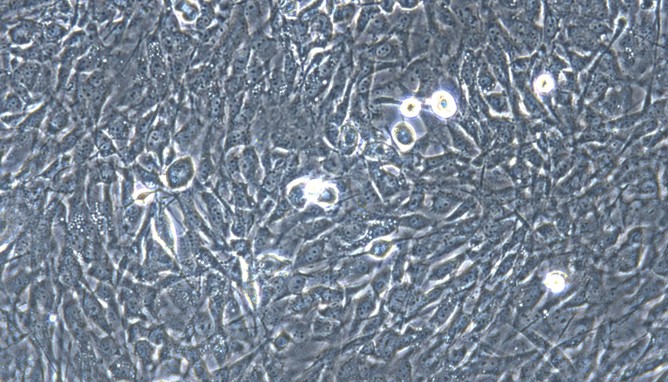 Primary Mouse Peritoneal Fibroblasts (PF)