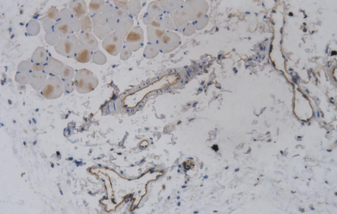 Mouse Model for Tumor Transplantation (TT)