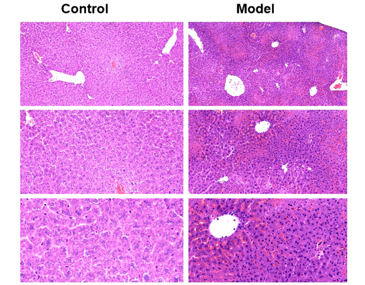 Mouse Model for Hepatitis