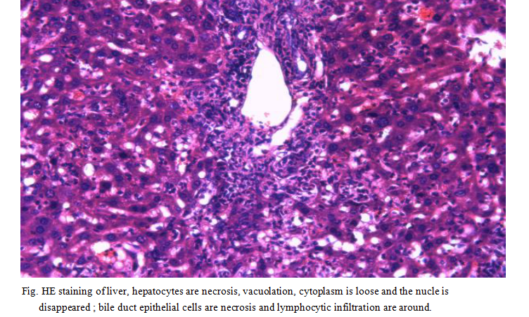 Mouse Model for Intrahepatic Cholestasis (IC)