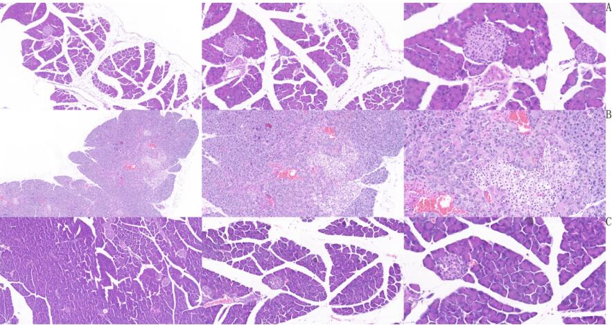 Mouse Model for Acute Pancreatitis (AP)