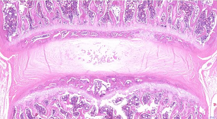 Rat Model for Intervertebral Disc Degeneration (DDD)