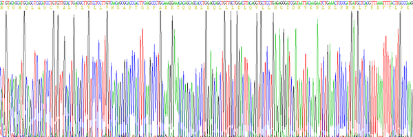 Eukaryotic Interleukin 2 (IL2)