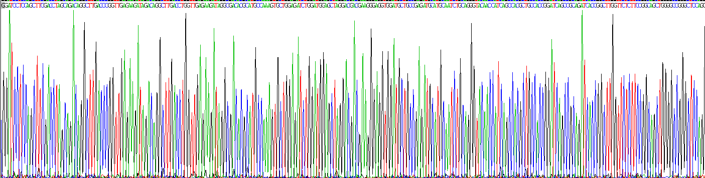 Eukaryotic Superoxide Dismutase 3, Extracellular (SOD3)