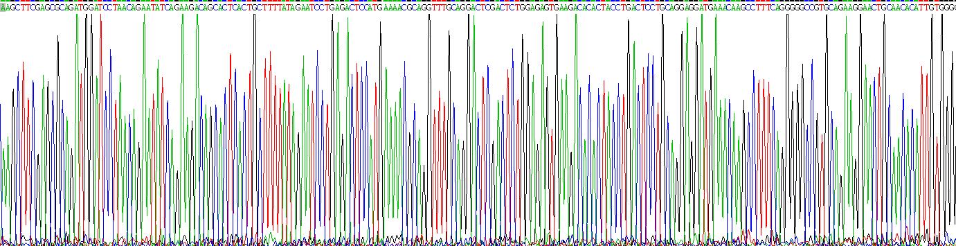 Eukaryotic Receptor Activator Of Nuclear Factor Kappa B Ligand (RANkL)