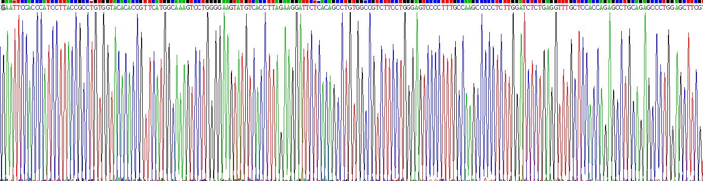 Eukaryotic Carboxylesterase 1 (CES1)