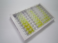 High Sensitive ELISA Kit for Lipopolysaccharide Binding Protein (LBP)