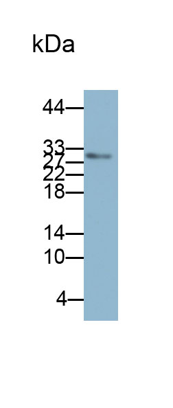 Biotin-Linked Polyclonal Antibody to Insulin Like Growth Factor Binding Protein 1 (IGFBP1)