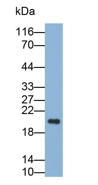 Biotin-Linked Polyclonal Antibody to Tissue Inhibitors Of Metalloproteinase 4 (TIMP4)