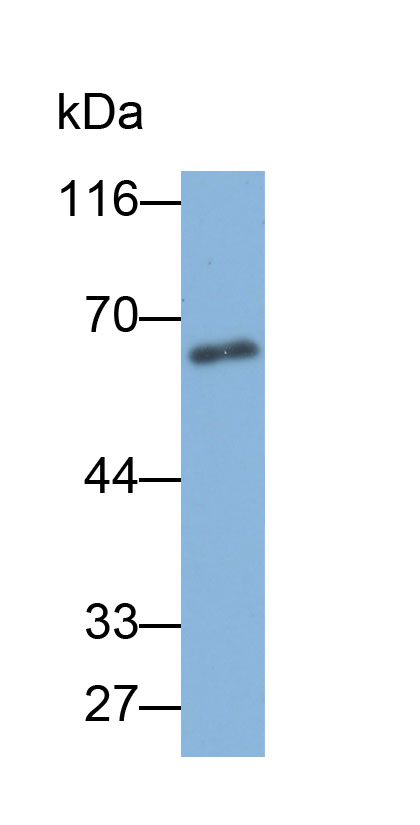 Biotin-Linked Polyclonal Antibody to Alpha-Fetoprotein (AFP)