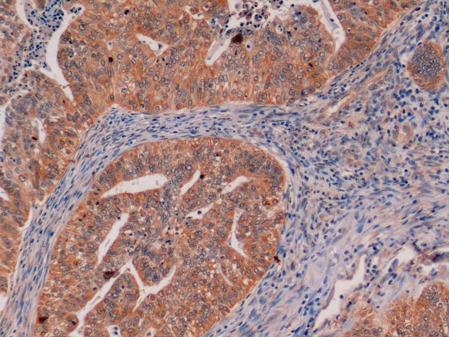 Biotin-Linked Polyclonal Antibody to Mucin 1 (MUC1)