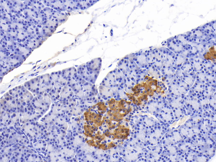 Biotin-Linked Polyclonal Antibody to C-Peptide (CP)