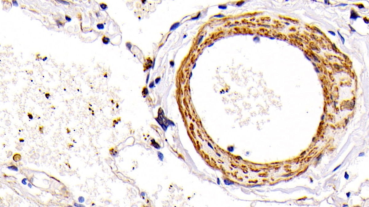 Biotin-Linked Monoclonal Antibody to Platelet Derived Growth Factor AA (PDGFAA)