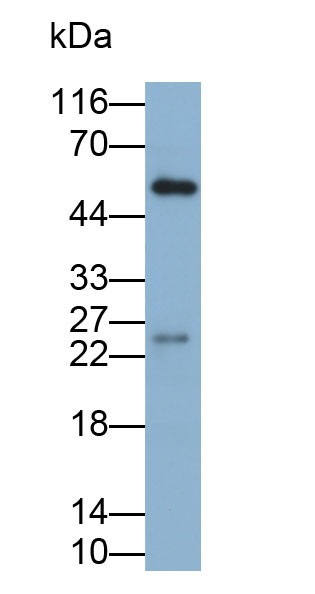 Biotin-Linked Polyclonal Antibody to Immunoglobulin A (IgA)