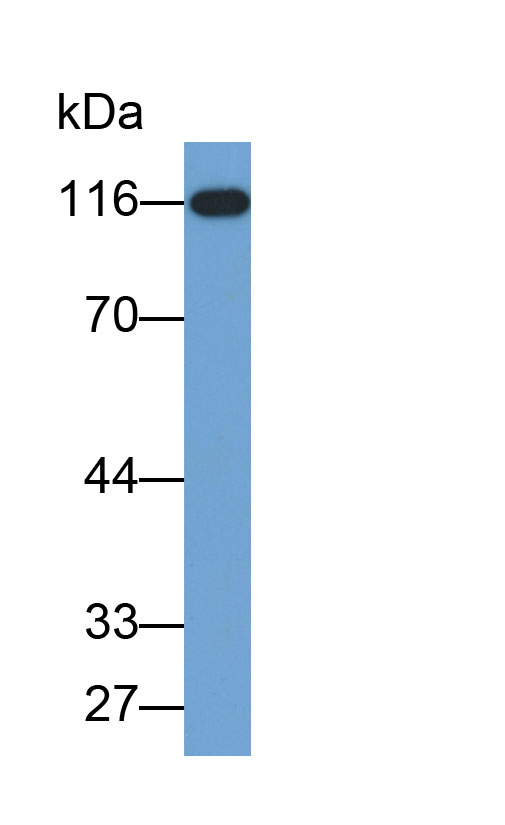 Biotin-Linked Polyclonal Antibody to Hexokinase 1 (HK1)