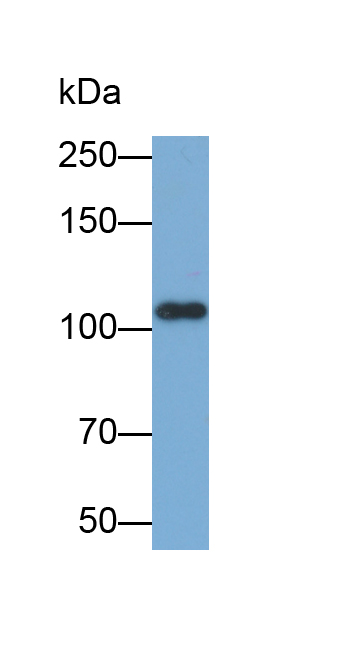 Biotin-Linked Polyclonal Antibody to Hexokinase 1 (HK1)