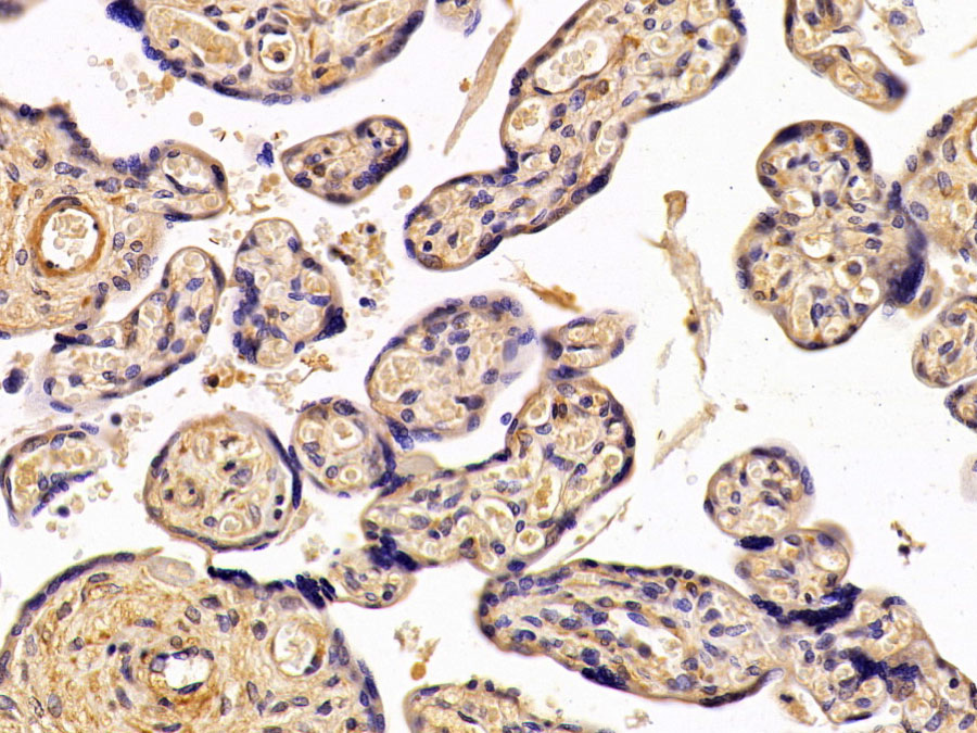 Biotin-Linked Polyclonal Antibody to Parathyroid Hormone Related Protein (PTHrP)