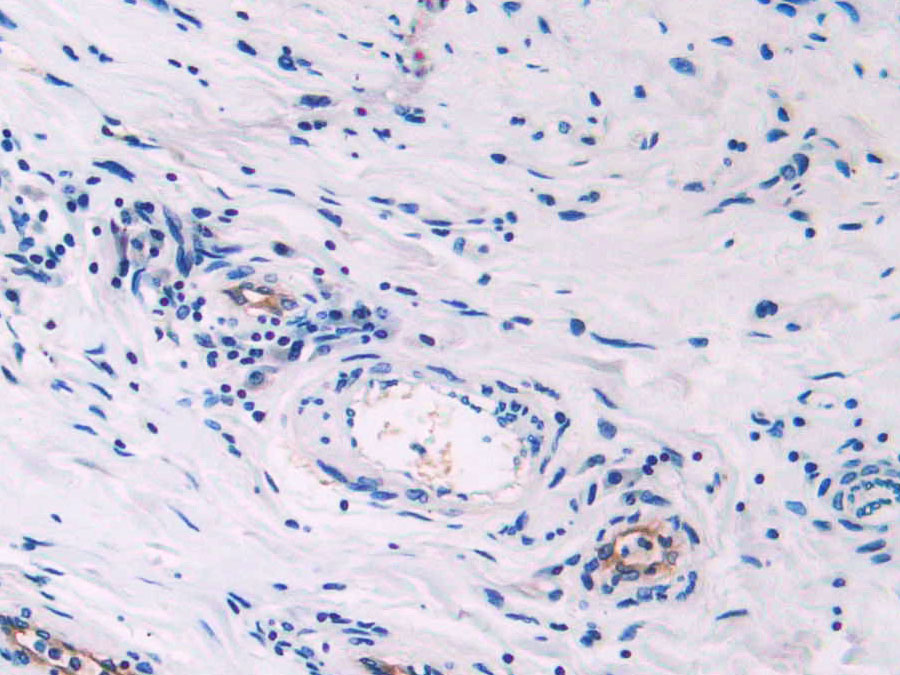 Biotin-Linked Polyclonal Antibody to Endoglin (ENG)