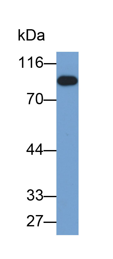 Biotin-Linked Polyclonal Antibody to Retinoblastoma Protein 1 (RB1)