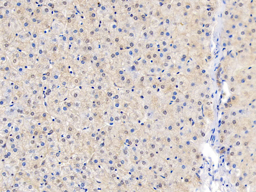 Biotin-Linked Polyclonal Antibody to Glucokinase Regulatory Protein (GKRP)