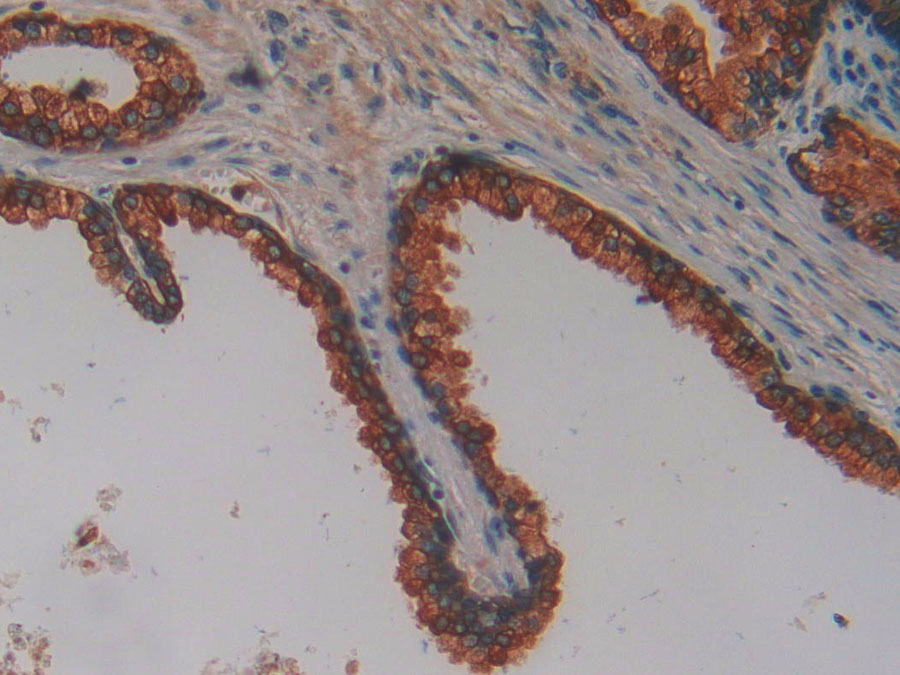 Biotin-Linked Polyclonal Antibody to Cytokeratin 8 (CK8)