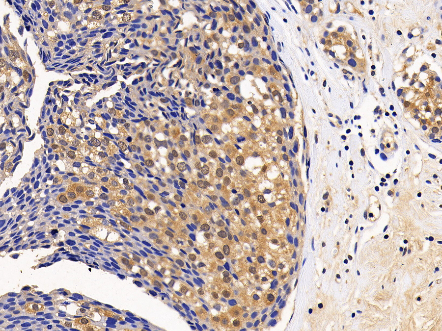 Biotin-Linked Polyclonal Antibody to Eukaryotic Translation Initiation Factor 4E Binding Protein 1 (EIF4EBP1)