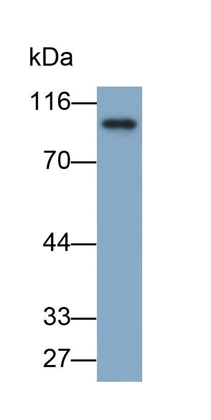Biotin-Linked Polyclonal Antibody to Suppression Of Tumorigenicity 14 (ST14)