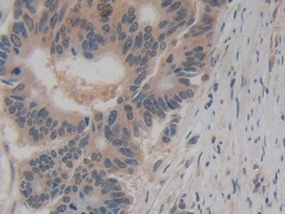 Monoclonal Antibody to Amphiregulin (AREG)