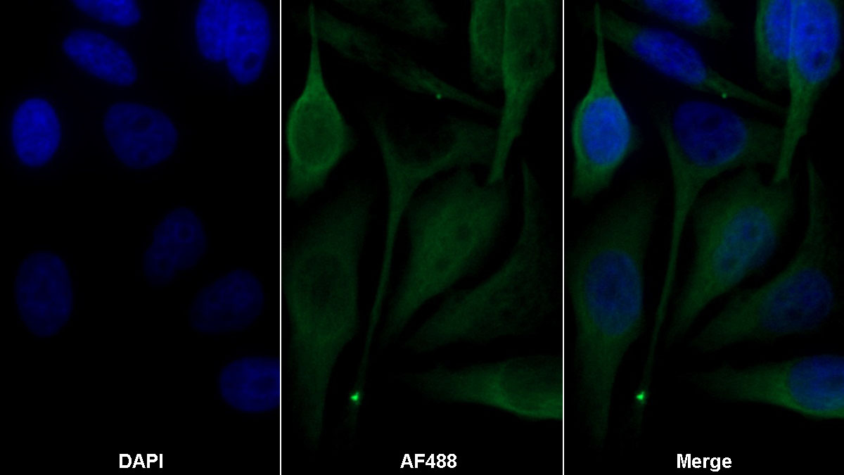 Monoclonal Antibody to Connective Tissue Growth Factor (CTGF)