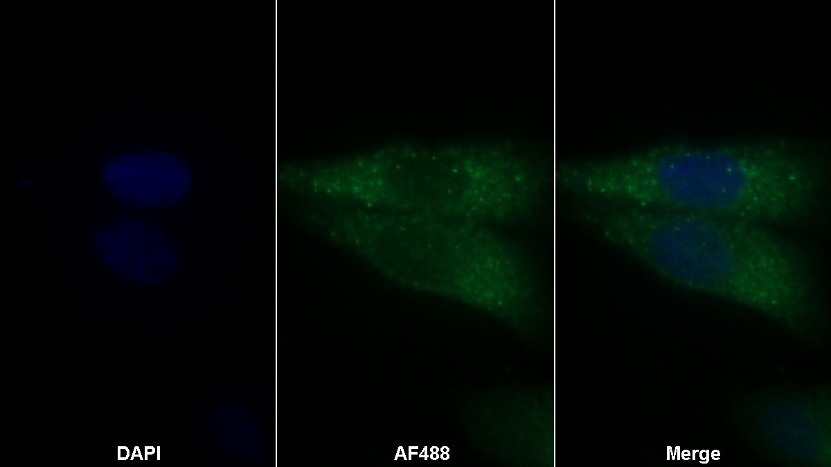 Monoclonal Antibody to Brain Derived Neurotrophic Factor (BDNF)