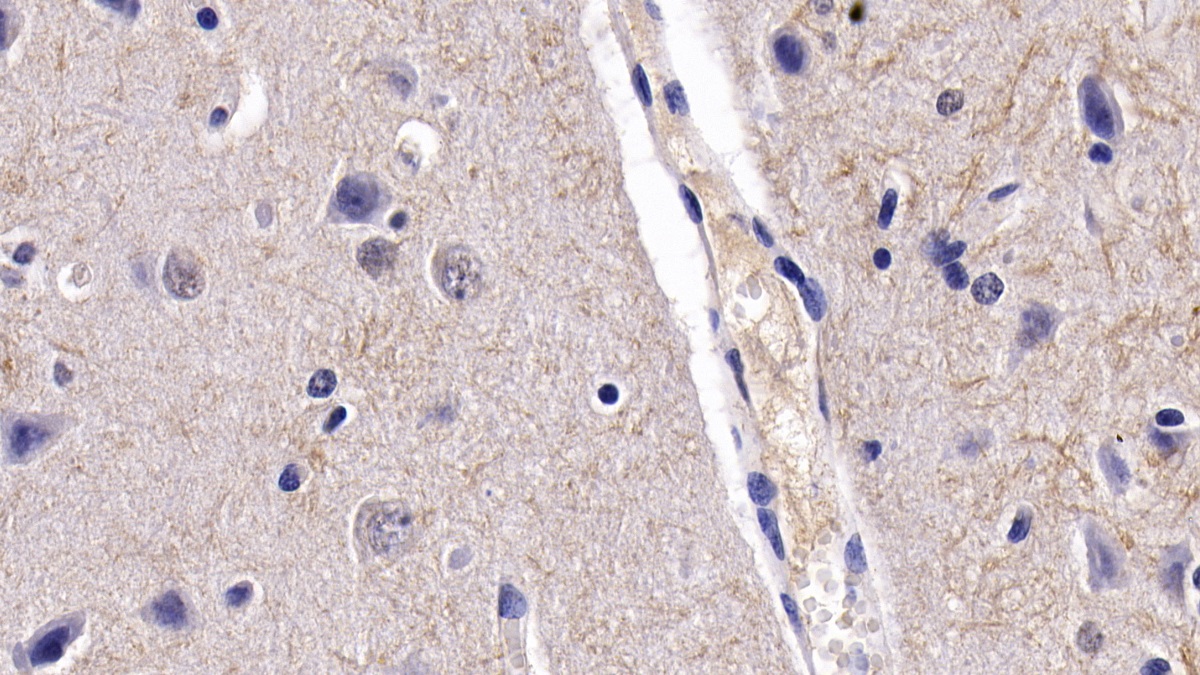Monoclonal Antibody to Brain Derived Neurotrophic Factor (BDNF)