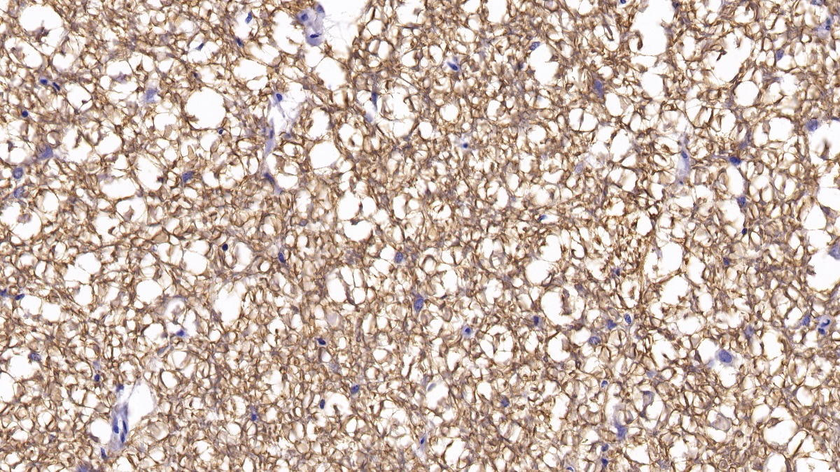 Monoclonal Antibody to Brain Derived Neurotrophic Factor (BDNF)