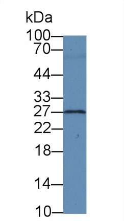 Monoclonal Antibody to Brain Derived Neurotrophic Factor (BDNF)