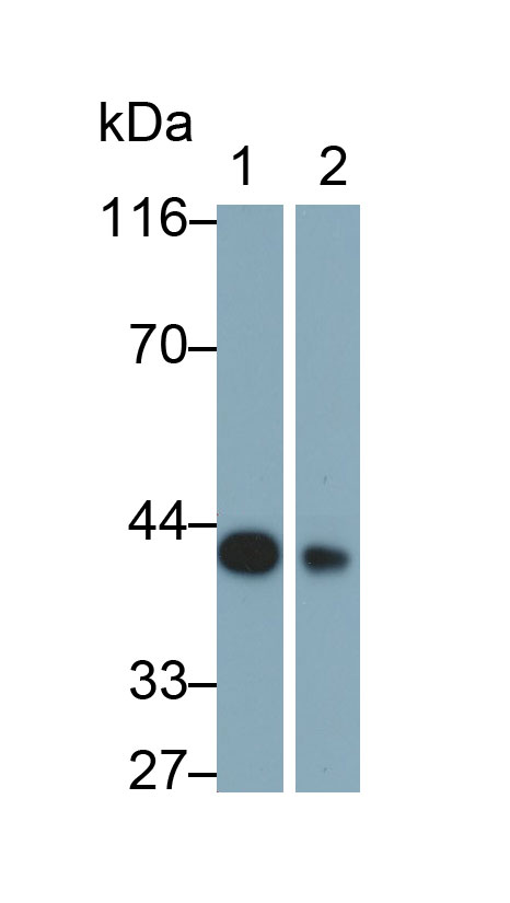 Monoclonal Antibody to Brain Derived Neurotrophic Factor (BDNF)