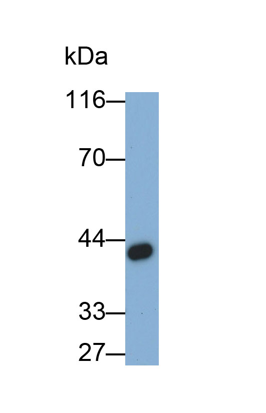 Monoclonal Antibody to Brain Derived Neurotrophic Factor (BDNF)