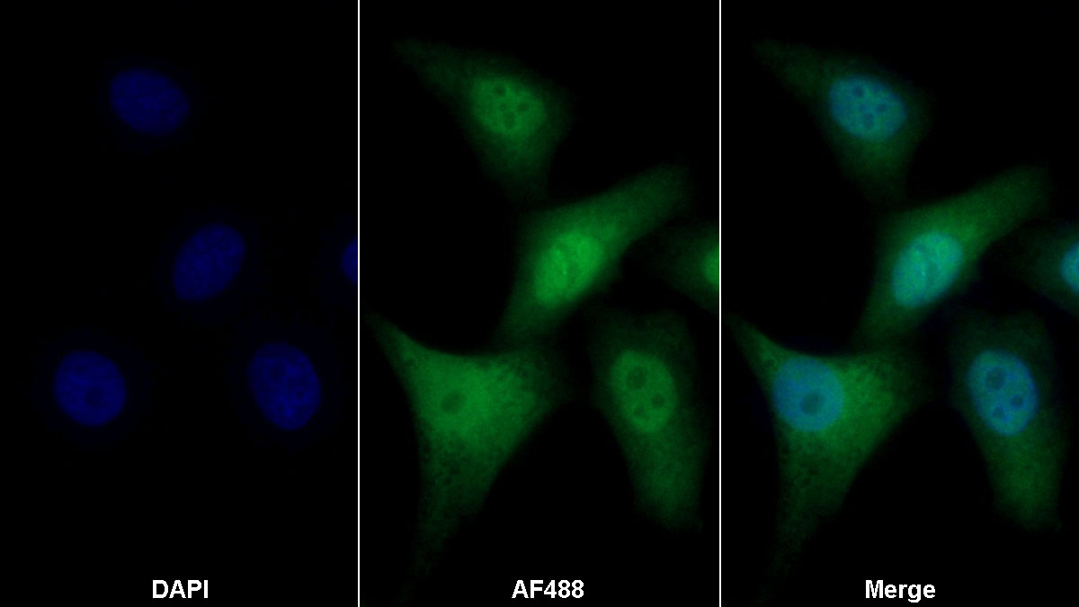 Monoclonal Antibody to S100 Calcium Binding Protein (S100)