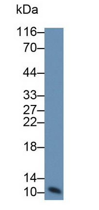 Monoclonal Antibody to S100 Calcium Binding Protein (S100)