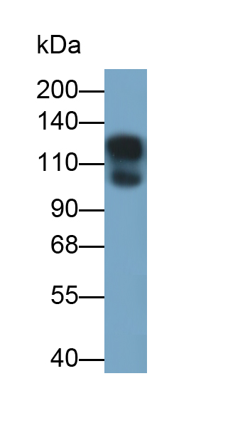 Monoclonal Antibody to E-cadherin