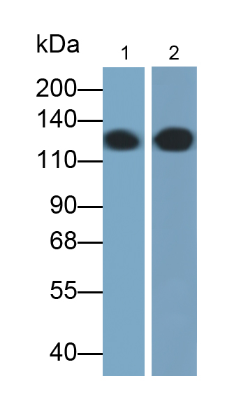 Monoclonal Antibody to E-cadherin