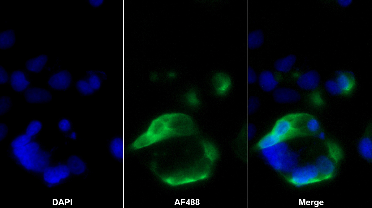 Monoclonal Antibody to E-cadherin